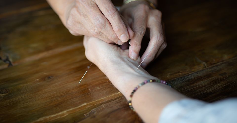 Acupunctuur-min